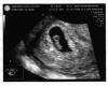 post-2177-133194778532_thumb.jpg